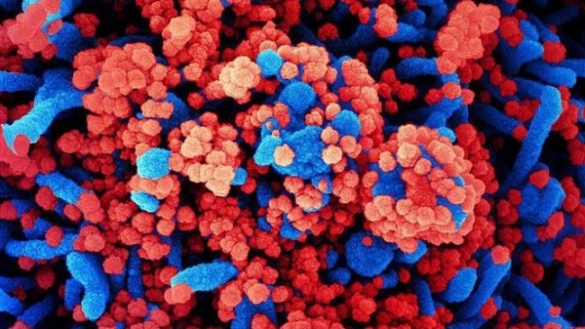 Bộ Y tế thông tin các trường hợp mắc bệnh chưa rõ nguyên nhân tại Nga