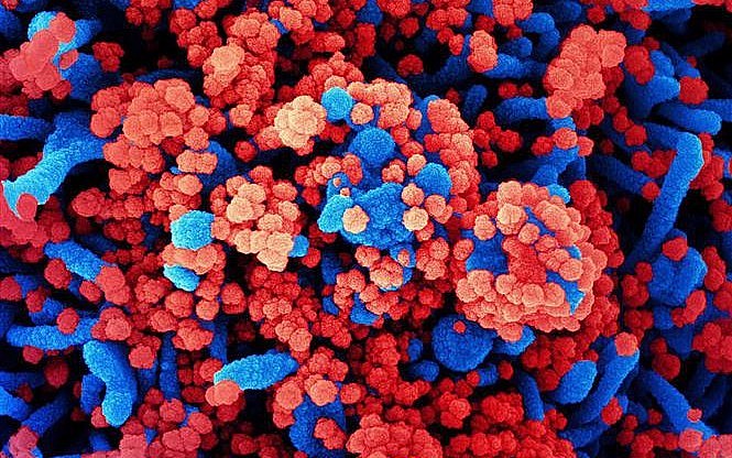 Bộ Y tế thông tin các trường hợp mắc bệnh chưa rõ nguyên nhân tại Nga